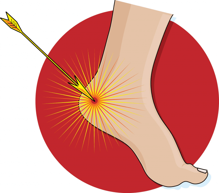 Arrow in the heel